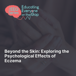 Click this image to view "Beyond the Skin: Exploring the Psychological Effects of Eczema"